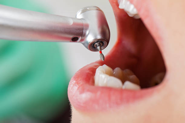 Best Emergency Dentist Open Today  in Monterey Park, CA